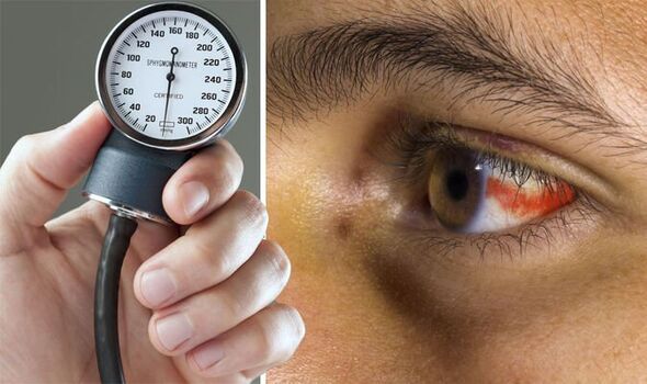 Eyes on Health: Don’t Let Hypertension Steal Your Sight! Unveil the link between high blood pressure and vision loss. Stay informed, stay proactive!