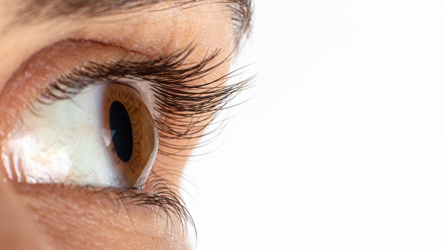 Keratoconus Day: A Vision for Awareness and Early Detection